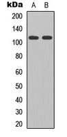 Western blot analysis of GLURD2 expression in HEK293T (A); mouse brain (B) whole cell lysates.