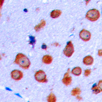 Immunohistochemical analysis of NMDAR1 staining in human brain formalin fixed paraffin embedded tissue section. The section was pre-treated using heat mediated antigen retrieval with sodium citrate buffer (pH 6.0). The section was then incubated with the antibody at room temperature and detected using an HRP conjugad compact polymer system. DAB was used as the chromogen. The section was then counterstained with haematoxylin and mounted with DPX.