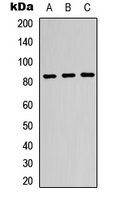 Western blot analysis of Beta-glucuronidase expression in K562 (A); HeLa (B); HepG2 (C) whole cell lysates.