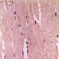 Immunohistochemical analysis of GYS1 (pS645) staining in human skeletal muscle formalin fixed paraffin embedded tissue section. The section was pre-treated using heat mediated antigen retrieval with sodium citrate buffer (pH 6.0). The section was then incubated with the antibody at room temperature and detected using an HRP conjugad compact polymer system. DAB was used as the chromogen. The section was then counterstained with haematoxylin and mounted with DPX.