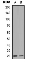 Western blot analysis of HEN1/2 expression in HEK293T (A); NIH3T3 (B) whole cell lysates.