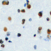 Immunohistochemical analysis of HEN1/2 staining in human brain formalin fixed paraffin embedded tissue section. The section was pre-treated using heat mediated antigen retrieval with sodium citrate buffer (pH 6.0). The section was then incubated with the antibody at room temperature and detected using an HRP conjugad compact polymer system. DAB was used as the chromogen. The section was then counterstained with haematoxylin and mounted with DPX.