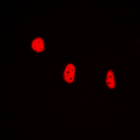 Immunofluorescent analysis of BRAF35 staining in HEK293T cells. Formalin-fixed cells were permeabilized with 0.1% Triton X-100 in TBS for 5-10 minutes and blocked with 3% BSA-PBS for 30 minutes at room temperature. Cells were probed with the primary antibody in 3% BSA-PBS and incubated overnight at 4 deg C in a hidified chamber. Cells were washed with PBST and incubated with a DyLight 594-conjugated secondary antibody (red) in PBS at room temperature in the dark. DAPI was used to stain the cell nuclei (blue).