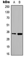 Western blot analysis of hnRNP A2/B1 expression in HeLa (A); PC3 (B) whole cell lysates.