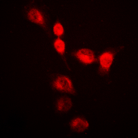 Immunofluorescent analysis of hnRNP A2/B1 staining in HeLa cells. Formalin-fixed cells were permeabilized with 0.1% Triton X-100 in TBS for 5-10 minutes and blocked with 3% BSA-PBS for 30 minutes at room temperature. Cells were probed with the primary antibody in 3% BSA-PBS and incubated overnight at 4 deg C in a hidified chamber. Cells were washed with PBST and incubated with a DyLight 594-conjugated secondary antibody (red) in PBS at room temperature in the dark. DAPI was used to stain the cell nuclei (blue).