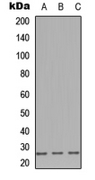 Western blot analysis of CD179b expression in A549 (A); NS-1 (B); PC12 (C) whole cell lysates.