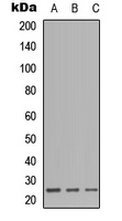 Western blot analysis of CD179b expression in HEK293T (A); Raw264.7 (B); H9C2 (C) whole cell lysates.