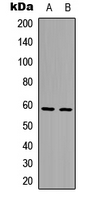 Western blot analysis of AIOLOS expression in HepG2 (A); HeLa (B) whole cell lysates.