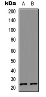 Western blot analysis of IL-17D expression in HeLa (A); Jurkat (B) whole cell lysates.