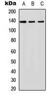 Western blot analysis of SHIP2 expression in A549 (A); NS-1 (B); PC12 (C) whole cell lysates.