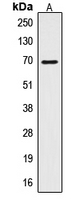 Western blot analysis of CTPS expression in HepG2 (A) whole cell lysates.
