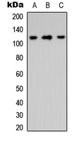Western blot analysis of Integrin alpha 8 HC expression in HeLa (A); Raw264.7 (B); PC12 (C) whole cell lysates.