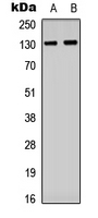 Western blot analysis of CD61 (pY773) expression in HUVEC (A); Raw264.7 (B) whole cell lysates.