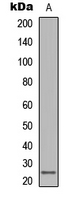 Western blot analysis of LT beta expression in human lymph node (A) whole cell lysates.