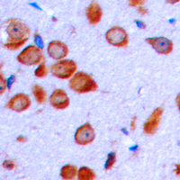 Immunohistochemical analysis of LT beta staining in human brain formalin fixed paraffin embedded tissue section. The section was pre-treated using heat mediated antigen retrieval with sodium citrate buffer (pH 6.0). The section was then incubated with the antibody at room temperature and detected using an HRP conjugad compact polymer system. DAB was used as the chromogen. The section was then counterstained with haematoxylin and mounted with DPX.