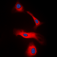 Immunofluorescent analysis of LT beta staining in HeLa cells. Formalin-fixed cells were permeabilized with 0.1% Triton X-100 in TBS for 5-10 minutes and blocked with 3% BSA-PBS for 30 minutes at room temperature. Cells were probed with the primary antibody in 3% BSA-PBS and incubated overnight at 4 deg C in a hidified chamber. Cells were washed with PBST and incubated with a DyLight 594-conjugated secondary antibody (red) in PBS at room temperature in the dark. DAPI was used to stain the cell nuclei (blue).