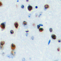 Immunohistochemical analysis of LYL1 staining in human brain formalin fixed paraffin embedded tissue section. The section was pre-treated using heat mediated antigen retrieval with sodium citrate buffer (pH 6.0). The section was then incubated with the antibody at room temperature and detected using an HRP conjugad compact polymer system. DAB was used as the chromogen. The section was then counterstained with haematoxylin and mounted with DPX.