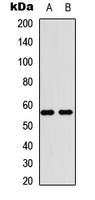 Western blot analysis of MBTPS2 expression in HEK293T (A); Raw264.7 (B) whole cell lysates.