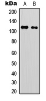 Western blot analysis of p116 Rip expression in Jurkat (A); rat muscle (B) whole cell lysates.