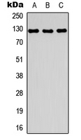 Western blot analysis of MYBPC1 expression in U2OS (A); mouse skeletal muscle (B); rat skeletal muscle (C) whole cell lysates.