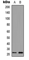 Western blot analysis of MYL3 expression in human heart (A); K562 (B) whole cell lysates.