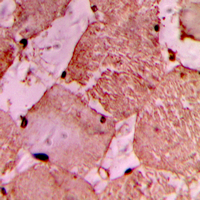 Immunohistochemical analysis of IDOL staining in human heart formalin fixed paraffin embedded tissue section. The section was pre-treated using heat mediated antigen retrieval with sodium citrate buffer (pH 6.0). The section was then incubated with the antibody at room temperature and detected using an HRP conjugad compact polymer system. DAB was used as the chromogen. The section was then counterstained with haematoxylin and mounted with DPX.