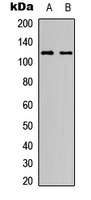Western blot analysis of NOTCH1 expression in HeLa (A); NIH3T3 (B) whole cell lysates.