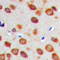 Immunohistochemical analysis of NOTCH1 staining in human brain formalin fixed paraffin embedded tissue section. The section was pre-treated using heat mediated antigen retrieval with sodium citrate buffer (pH 6.0). The section was then incubated with the antibody at room temperature and detected using an HRP conjugad compact polymer system. DAB was used as the chromogen. The section was then counterstained with haematoxylin and mounted with DPX.