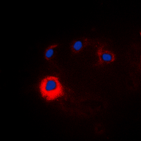 Immunofluorescent analysis of NOTCH1 staining in HeLa cells. Formalin-fixed cells were permeabilized with 0.1% Triton X-100 in TBS for 5-10 minutes and blocked with 3% BSA-PBS for 30 minutes at room temperature. Cells were probed with the primary antibody in 3% BSA-PBS and incubated overnight at 4 deg C in a hidified chamber. Cells were washed with PBST and incubated with a DyLight 594-conjugated secondary antibody (red) in PBS at room temperature in the dark. DAPI was used to stain the cell nuclei (blue).