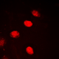 Immunofluorescent analysis of NPAS4 staining in HEK293T cells. Formalin-fixed cells were permeabilized with 0.1% Triton X-100 in TBS for 5-10 minutes and blocked with 3% BSA-PBS for 30 minutes at room temperature. Cells were probed with the primary antibody in 3% BSA-PBS and incubated overnight at 4 deg C in a hidified chamber. Cells were washed with PBST and incubated with a DyLight 594-conjugated secondary antibody (red) in PBS at room temperature in the dark. DAPI was used to stain the cell nuclei (blue).