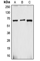 Western blot analysis of gp91 phox expression in HepG2 (A); Caco2 (B); MCF7 (C) whole cell lysates.