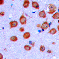 Immunohistochemical analysis of OLFML2A staining in human brain formalin fixed paraffin embedded tissue section. The section was pre-treated using heat mediated antigen retrieval with sodium citrate buffer (pH 6.0). The section was then incubated with the antibody at room temperature and detected using an HRP conjugad compact polymer system. DAB was used as the chromogen. The section was then counterstained with haematoxylin and mounted with DPX.