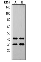 Western blot analysis of OVOL1 expression in A549 (A); Jurkat (B) whole cell lysates.