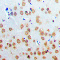 Immunohistochemical analysis of PARP3 staining in human brain formalin fixed paraffin embedded tissue section. The section was pre-treated using heat mediated antigen retrieval with sodium citrate buffer (pH 6.0). The section was then incubated with the antibody at room temperature and detected using an HRP conjugad compact polymer system. DAB was used as the chromogen. The section was then counterstained with haematoxylin and mounted with DPX.