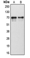 Western blot analysis of Cytochrome P450 1B1 expression in human tonsil (A); human liver (B) whole cell lysates.