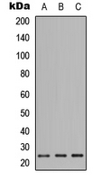 Western blot analysis of PIGF expression in HEK293T (A); Raw264.7 (B); H9C2 (C) whole cell lysates.
