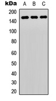 Western blot analysis of PLC gamma 2 expression in HeLa (A); Raw264.7 (B); rat lung (C) whole cell lysates.