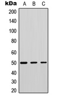 Western blot analysis of Phospholipase D4 expression in human tonsil (A); mouse testis (B); mouse muscle (C) whole cell lysates.