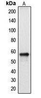 Western blot analysis of Cytochrome P450 2A13 expression in HepG2 (A) whole cell lysates.