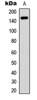 Western blot analysis of PNPLA6 expression in SHSY5Y (A) whole cell lysates.