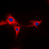 Immunofluorescent analysis of Cytochrome P450 2A13 staining in HepG2 cells. Formalin-fixed cells were permeabilized with 0.1% Triton X-100 in TBS for 5-10 minutes and blocked with 3% BSA-PBS for 30 minutes at room temperature. Cells were probed with the primary antibody in 3% BSA-PBS and incubated overnight at 4 C in a humidified chamber. Cells were washed with PBST and incubated with a DyLight 594-conjugated secondary antibody (red) in PBS at room temperature in the dark. DAPI was used to stain the cell nuclei (blue).
