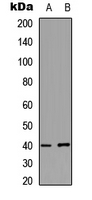 Western blot analysis of PKA C gamma expression in HeLa (A); MCF7 (B) whole cell lysates.