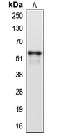 Western blot analysis of Cytochrome P450 2A6 expression in HepG2 (A) whole cell lysates.