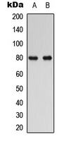 Western blot analysis of RAD17 expression in human Oral cancer (A); HuvEc (B) whole cell lysates.