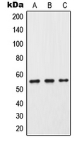 Western blot analysis of Cytochrome P450 2C9 expression in HeLa (A); Raw264.7 (B); PC12 (C) whole cell lysates.