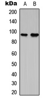 Western blot analysis of G15 expression in RT4 (A); NIH3T3 (B) whole cell lysates.