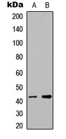 Western blot analysis of hnRNP G expression in Jurkat (A); RT4 (B) whole cell lysates.