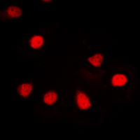Immunofluorescent analysis of hnRNP G staining in Jurkat cells. Formalin-fixed cells were permeabilized with 0.1% Triton X-100 in TBS for 5-10 minutes and blocked with 3% BSA-PBS for 30 minutes at room temperature. Cells were probed with the primary antibody in 3% BSA-PBS and incubated overnight at 4 deg C in a hidified chamber. Cells were washed with PBST and incubated with a DyLight 594-conjugated secondary antibody (red) in PBS at room temperature in the dark. DAPI was used to stain the cell nuclei (blue).