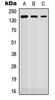 Western blot analysis of ROBO2 expression in HEK293T (A); Raw264.7 (B); H9C2 (C) whole cell lysates.