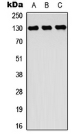 Western blot analysis of ROR2 expression in HeLa (A); Raji (B); MCF7 (C) whole cell lysates.